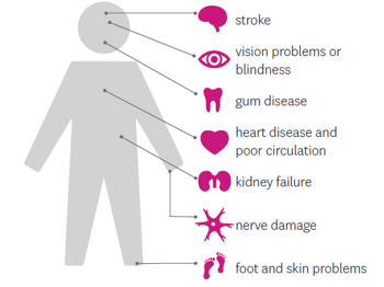 List of Diabetes Complications